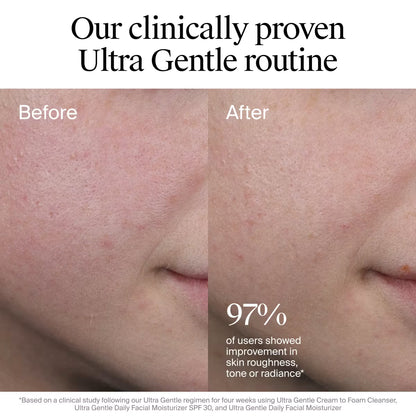 Neutrogena® Ultra Gentle Daily Facial Moisturizer with Broad Spectrum SPF 30, 3.4 Fl. Oz - US 3122