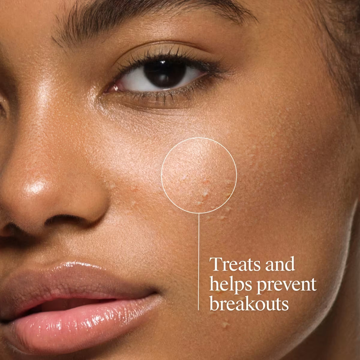 Neutrogena® Oil-Free Acne Wash, Fragrance Free 9.1 FL. Oz - US 6463