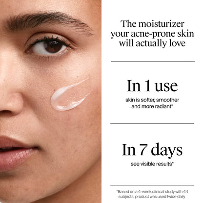 Neutrogena® Acne-Fighting Skincare Solutions Regimen Duo - US 2656